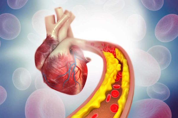 cholesterol-heart-2